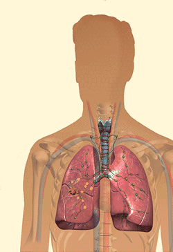 Schaubild der menschlichen Lunge