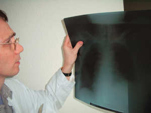 Rntgenaufnahme der Lunge
