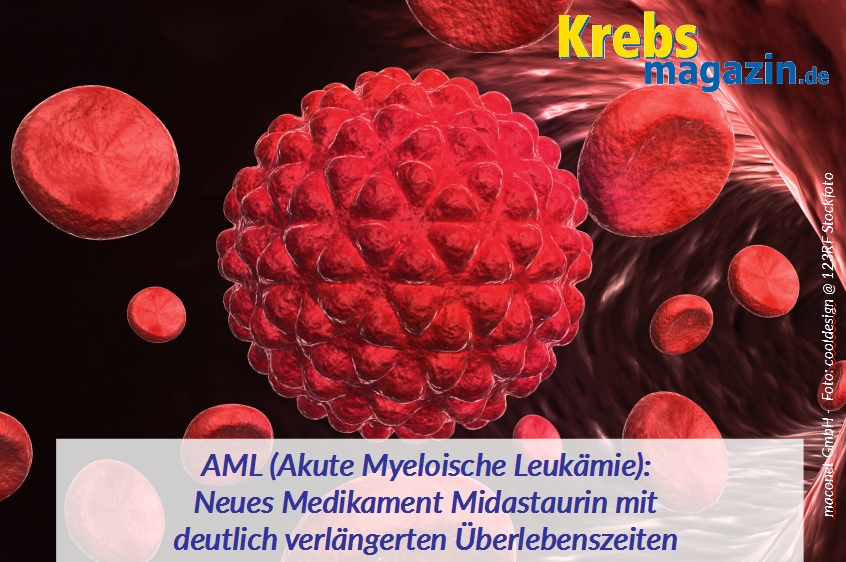 AML Neues Medikament Midastaurin mit deutlich verlängerten Überlebenszahlen
